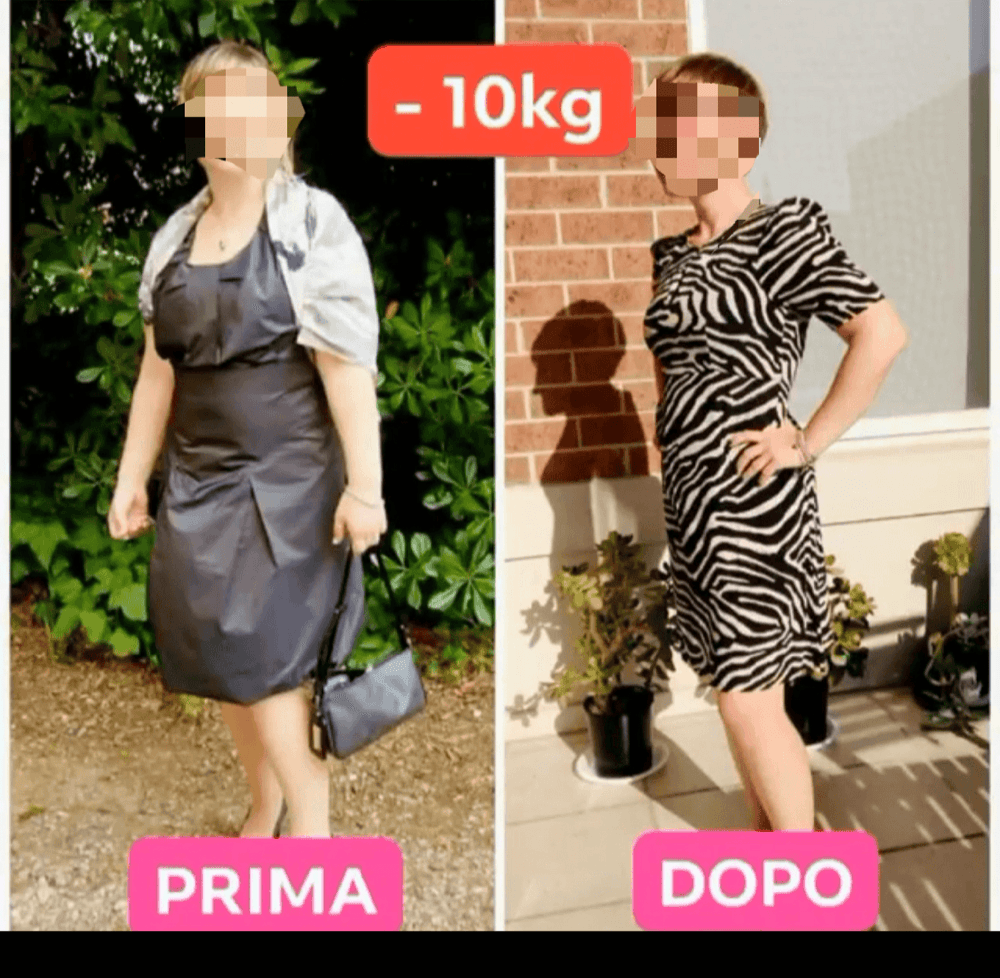 Trasformazione di una paziente, meno 10 kg