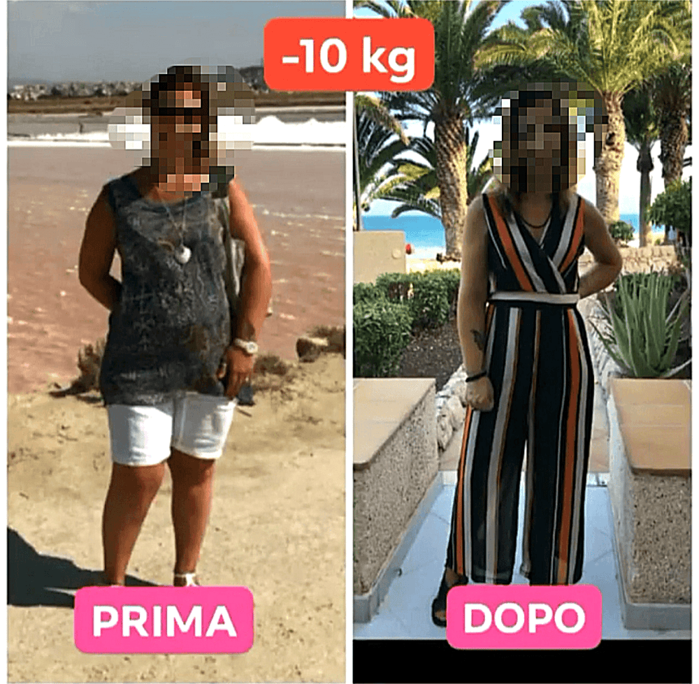 Trasformazione di una paziente in vacanza, meno 10 kg